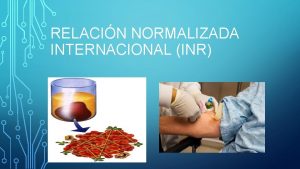 Relación normalizada internacional