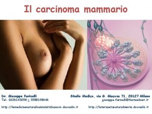 Il carcinoma mammario Dr Giuseppe Fariselli Tel 0226143258