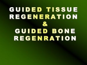 Guided tissue regenration Guided tissue regenration