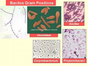 Bacilos Gram Positivos Bacillus Clostridium Corynebacterium Propionibacteri um