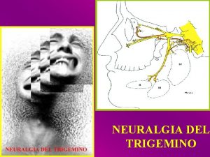 NEURALGIA DEL TRIGEMINO NERVIOS CRANEALES Contienen fibras sensitivas