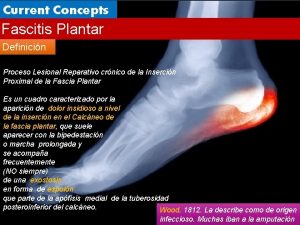 Update Concepts Current Fascitis Plantar Definicin Proceso Lesional