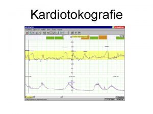 Kardiotokografie Definice Kontinuln registrace srden akce plodu zznam