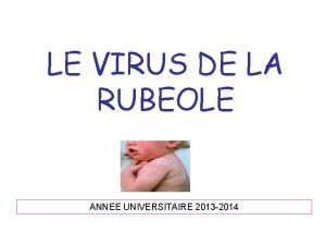 LE VIRUS DE LA RUBEOLE ANNEE UNIVERSITAIRE 2013