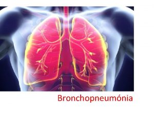 Bronchopneumnia Bronchopneumnia aktny zpal pcneho parenchmu pomerne ast