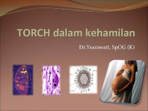 TORCH dalam kehamilan Dr Yusrawati Sp OG K