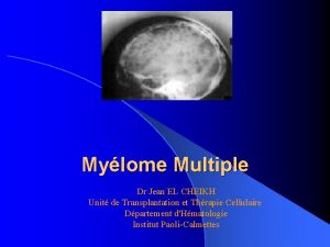 Mylome Multiple Dr Jean EL CHEIKH Unit de