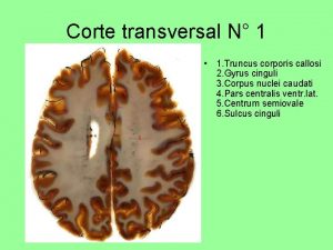 Corte transversal N 1 1 Truncus corporis callosi