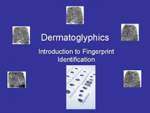 Dermatoglyphics Introduction to Fingerprint Identification Fingerprinting A fingerprint