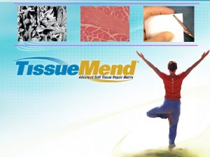 Tissue mend