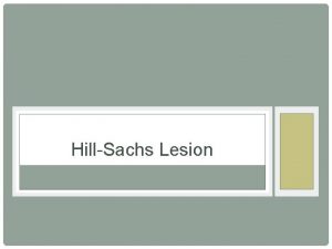 HillSachs Lesion Description It is a compression fracture