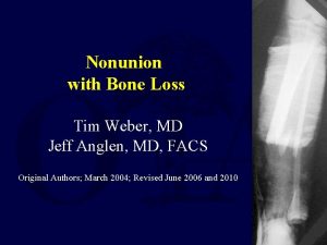 Nonunion with Bone Loss Tim Weber MD Jeff