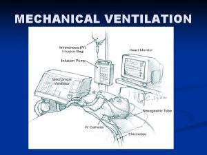 MECHANICAL VENTILATION INTUBATION n Endotracheal Intubation n n