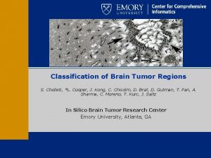 Classification of Brain Tumor Regions S Cholleti L