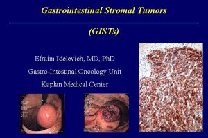 Gastrointestinal Stromal Tumors GISTs Efraim Idelevich MD Ph