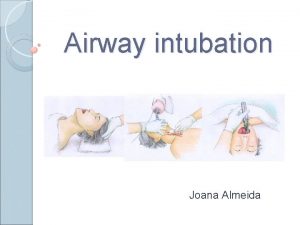 Sniffing position for intubation