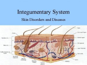 Integumentary System Skin Disorders and Diseases Contact Dermatitis