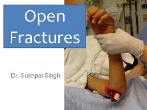 Classification of open fractures