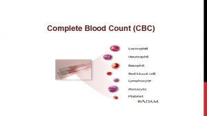 Cbc platelet count low