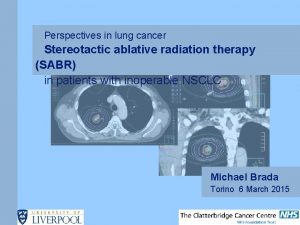 Perspectives in lung cancer Stereotactic ablative radiation therapy