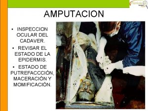 AMPUTACION INSPECCION OCULAR DEL CADAVER REVISAR EL ESTADO