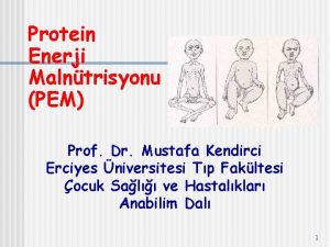 Protein Enerji Malntrisyonu PEM Prof Dr Mustafa Kendirci
