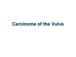 Carcinoma of the Vulva Incidence of malignant diseases