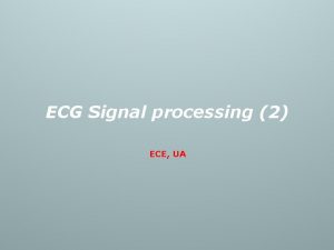 ECG Signal processing 2 ECE UA ECG signal
