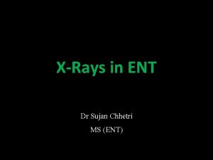 XRays in ENT Dr Sujan Chhetri MS ENT