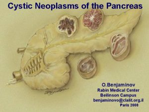 Cystic Neoplasms of the Pancreas O Benjaminov Rabin