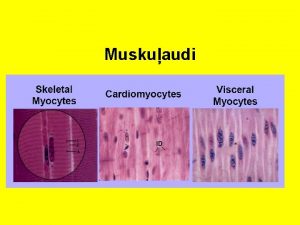 Kuri muskuļaudi satur miofibrillas