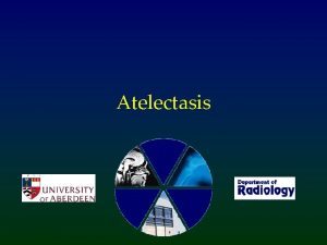 Atelectasis What does atelectasis mean Lung collapse with