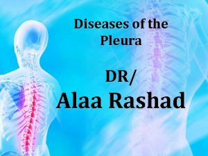 Diseases of the Pleura DR Alaa Rashad Diseases