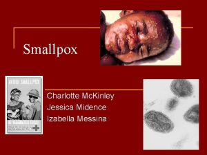 Smallpox Charlotte Mc Kinley Jessica Midence Izabella Messina