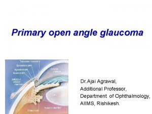 Primary open angle glaucoma Dr Ajai Agrawal Additional