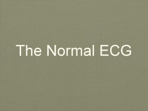 The Normal ECG Normal P Wave Negative in