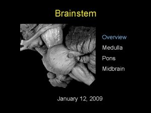 Brainstem Overview Medulla Pons Midbrain January 12 2009