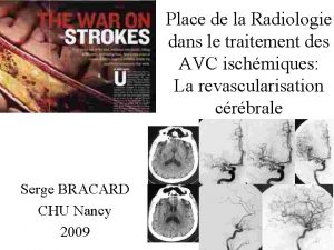 Place de la Radiologie dans le traitement des