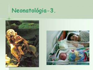 Neonatolgia3 jszlttkori fertzsek n n n Intrauterin infecti
