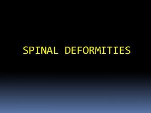 SPINAL DEFORMITIES NORMAL SPINE ALLIGNMENT FRONTAL PLANE STRAIGHT