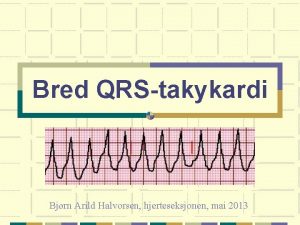 Sinusrytme med ves