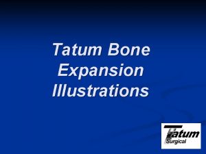 Tatum surgical Tatum surgical