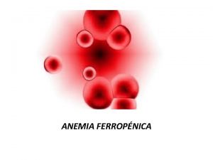 Vcm anemia ferropenica