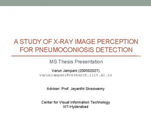 A STUDY OF XRAY IMAGE PERCEPTION FOR PNEUMOCONIOSIS