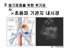 Non small cell lung cancer cisplatin vinorelbine taxol