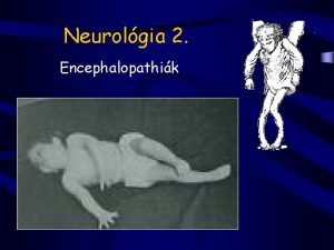 Neurolgia 2 Encephalopathik Encephalopathik Az agyi funkci generalizlt