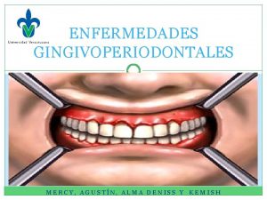 ENFERMEDADES GINGIVOPERIODONTALES MERCY AGUSTN ALMA DENISS Y KEMISH