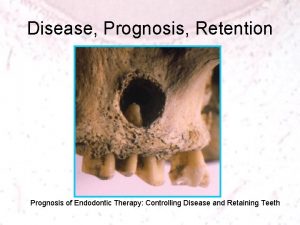 Disease Prognosis Retention Prognosis of Endodontic Therapy Controlling Disease Prognosis Retention Prognosis of Endodontic Therapy Controlling
