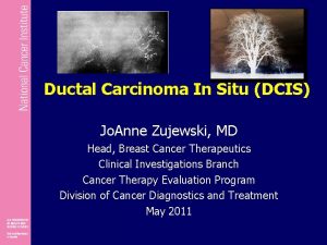Ductal Carcinoma In Situ DCIS Jo Anne Zujewski