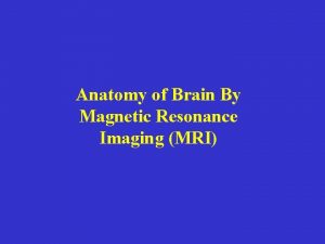 Anatomy of Brain By Magnetic Resonance Imaging MRI